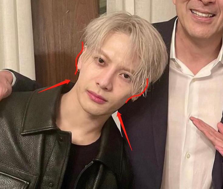 深度解析明星整容后遺癥，觀點(diǎn)與影響探討