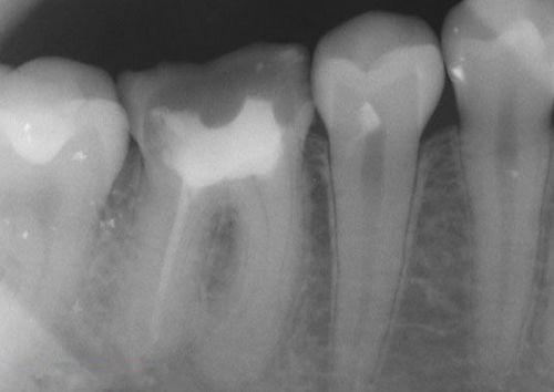 中國(guó)再生牙齒研究新進(jìn)展，重塑微笑，科技引領(lǐng)牙齒再生新篇章
