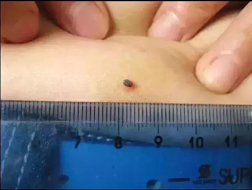 小明快樂疫情日志，最新疫情發(fā)布與日常觀察