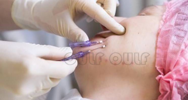 線(xiàn)雕最新手法，背景、發(fā)展、時(shí)代地位及展望